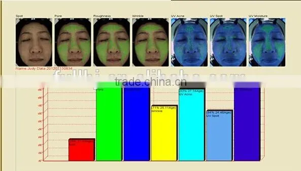 3D Intelligent Skin Analyzer Machine Best Selling Skin Analyzing Equipment photo-6