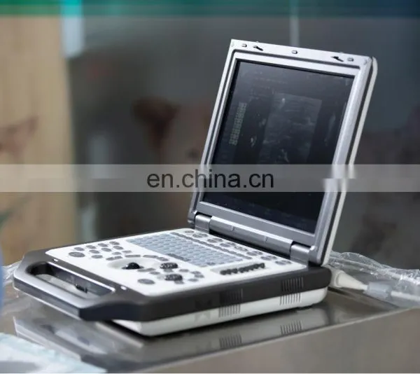 Veterinary Ultrasound Scanner Portable Color 3d Ultrasound Machine Electric Ce Mobile Trolley or Carrying Bag 24 15 LCD Monitor photo-5