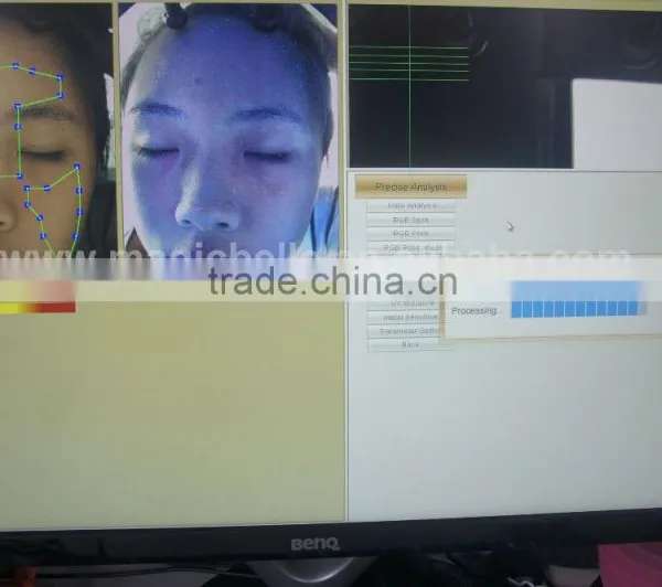 Health Body Digital Analizers the Price of a Dialysis Skin Analyzer Camera for Family Use photo-6