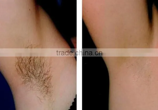 Elight SHR IPL Hair Removal &Skin Rejuveantion Elight Machine&ND Yag Laser photo-6