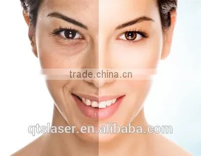 Ipl Laser + rf Hair Removal Set/acne Removal/wrinkle Removal photo-4