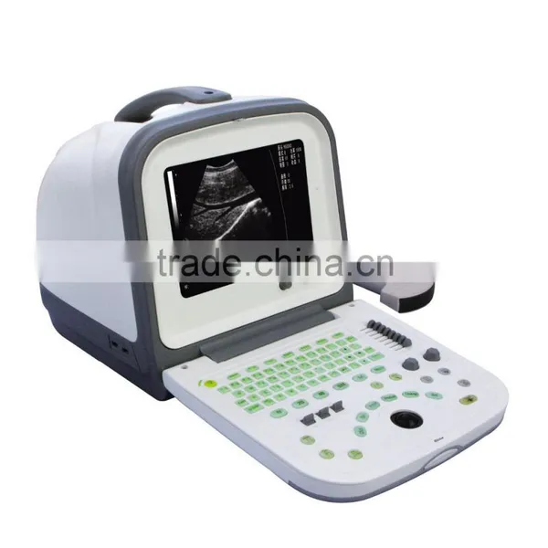 HY5511 Digital B/W Portable Ultrasonic Diagnostic System