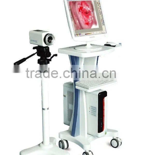 Colposcope 2100I