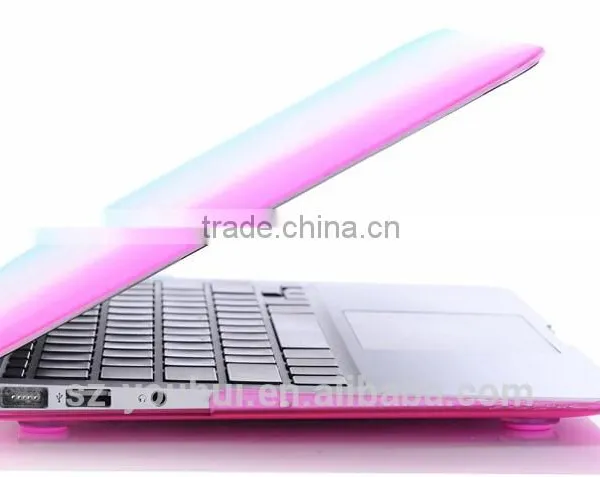 New Fashion Design Hard Case for Macbook Pro 17 photo-3
