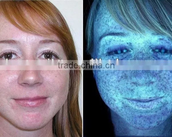 Professional Box System UV Skin Scanner Analyzer photo-6