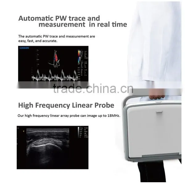 New Laptop/Portable Color Doppler 3D/4D Ultrasound Diagnostic System Machine Q9 photo-2