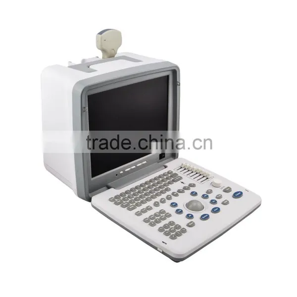 High Performance Low Price Ultrasound Machine photo-5