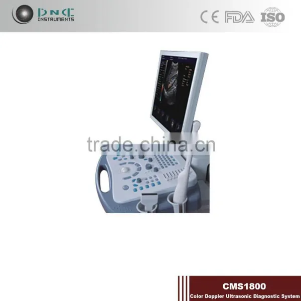 Top Grade Hotsale Link Digital Non-Interlaced Portable Ultrasound Scanner 200D With Low Price photo-6