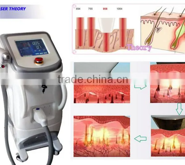 Best Soprano Laser Hair Removal Machine Price photo-6