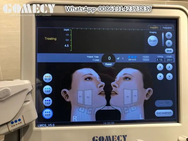 Ulthera HIFU Korean Anti-aging Machine Wrinkle Removal Face Lift Skin Tightening HIFU Body Shaping Cartridge photo-3