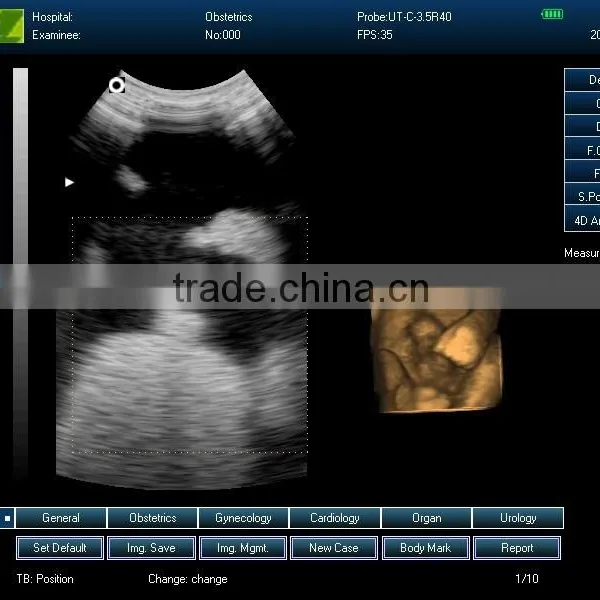 Ultrasound Machine ,ultrasound Machine Price,ultrasound Scanner photo-4