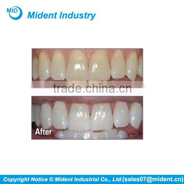 Professional Led Teeth Whitening Kit, Whitening Teeth With Blue Light photo-6