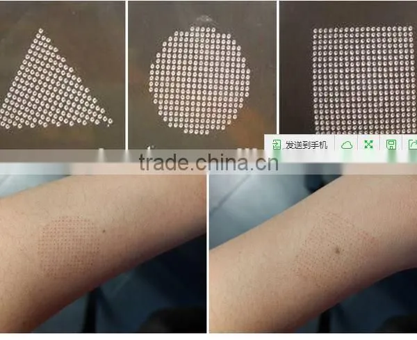 Skin Resurfacing Fractional CO2 Laser For Skin Resurfacing Laser 100um-2000um Skin Whitening Machine With CE Mole Removal Eliminate Body Odor photo-6