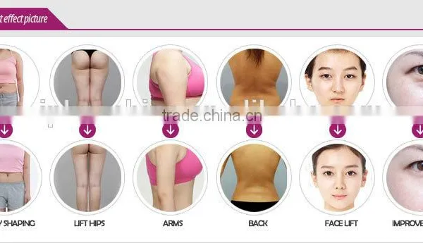 Popular Fast Slimming Machine for Weight Loss photo-6
