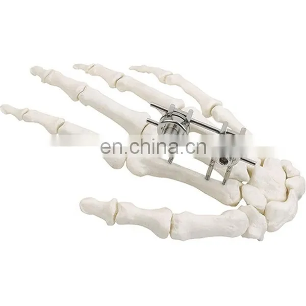 Guaranteed Quality Semi-circular External Fixator Orthopedic Surgical Implant photo-3