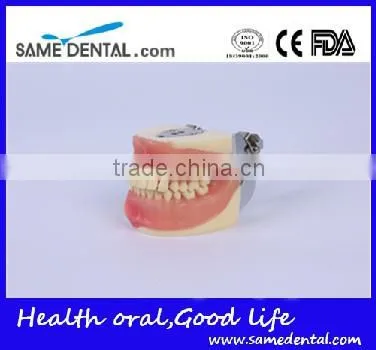 Dental Surgical Integrated Model Teaching Demonstration Teeth Model photo-3