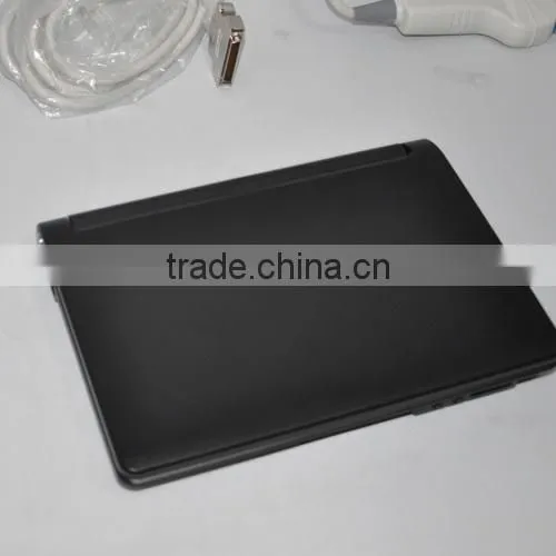 CE Approved LCD 10.4 Inch Laptop Ultrasound Machine RUS-9000F With Battery With Cheap Price photo-5