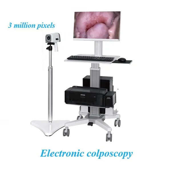 High Definition Digital Electronic Colposcope photo-5