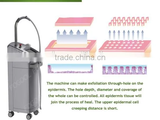 1540nm Erbium Glass Fractional Laser/ 1550nm Erbium Glass Fiber Laser Fogool Beijing photo-6