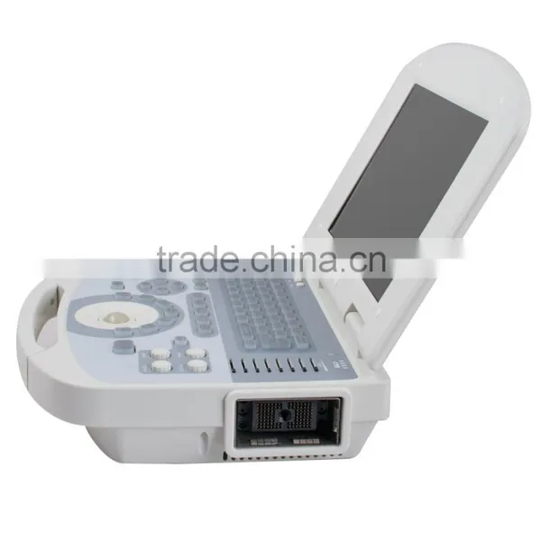 2017 Full Digital Portable Ultrasound Scanner ForAbdomen, Cardiac, Gynecology, Obstetrics Use photo-6