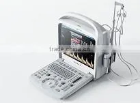 New Type Laptop Color Doppler Ultrasound for Human With Laptop photo-3