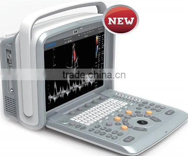 Laptop Color Doppler Ultrasound Price & Portable Color Doppler Ultrasound Machine photo-4