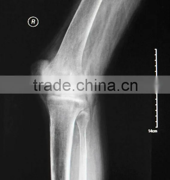 Computed Radiography Accesories,medical Dry Film