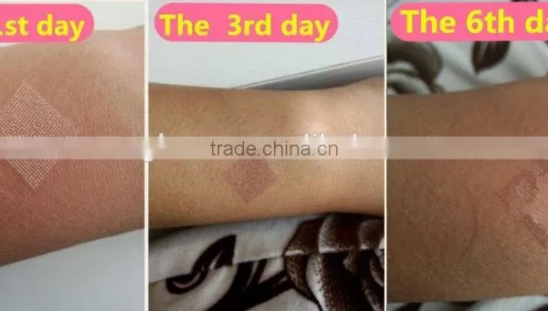 100um-2000um Fractional Laser Co2 / Co2 Fractional Laser RF Professional / Fractional Co2 Laser Scar Removal Machine Birth Mark Removal photo-6