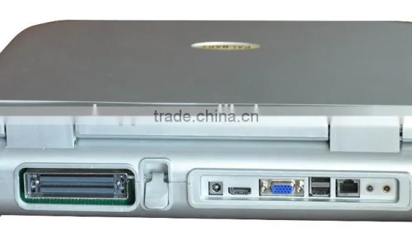 15 Inch Laptop Color Doppler 64G Image-storage Capacity Ultrasound Scanner for Hospital photo-5