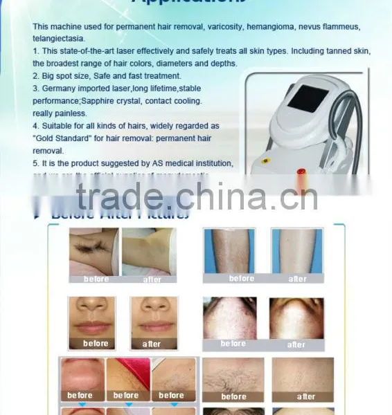 50-60HZ 808nm Diode Laser Unwanted Hair Permanent Hair Removal Machine 3000W photo-4