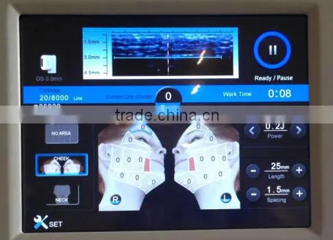 New System HIFU Equipment for Skin Lifting and Body Slimming photo-4