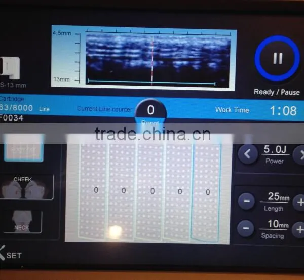 High Intensity Focused Ultrasound Face Lifting/Skin Tightening/Fat Removal photo-3