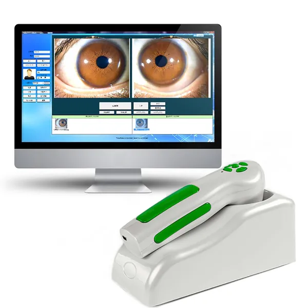 Digital Iriscope 12mp Iridology Camera Eye Iriscope Camera Analyzer photo-2
