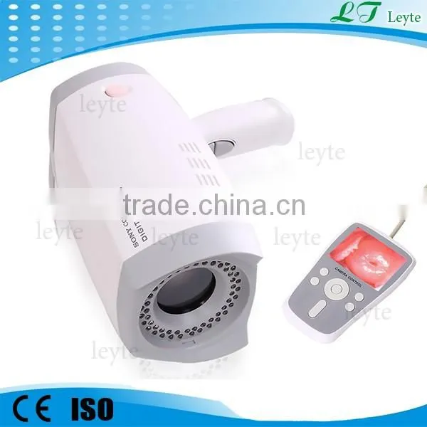 LTY9801 Portable Beautiful Full hd Vagina Colposcope photo-2