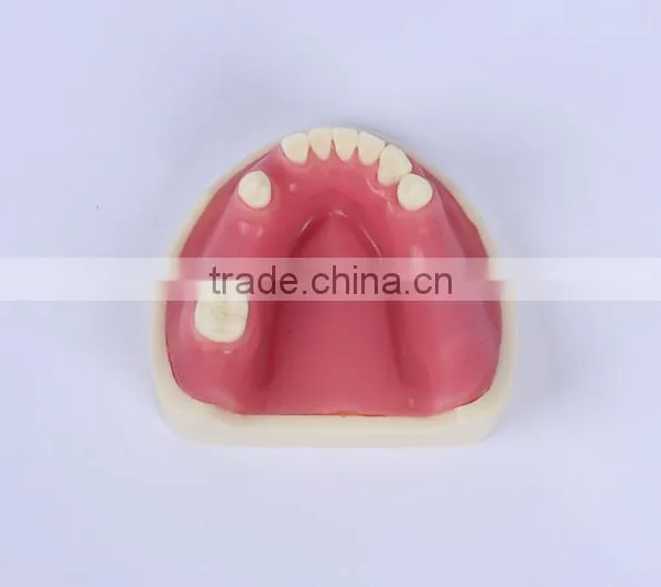 Trade Assurance Hot Dental Implant System CE Approved Dental Implant Model photo-2