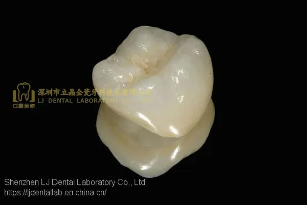 Dental Crown 3M Lava Zirconia, Dental Teeth, Dental Prosthesis, Laboratoire Dentaire, Dentallabor, Laboratorio Dental, Dental Laboratory, Shenzhen LJ Dental Lab China
