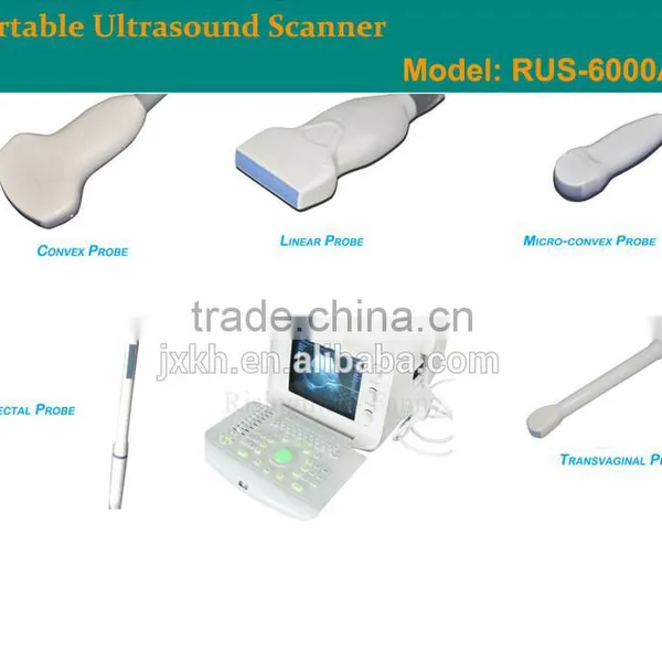 1 USB Factory Price OEM Design 80 Elements R60 Ultrasound Scanner for Pregnancy photo-6