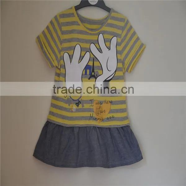 Yellow Short Dress Beautiful Girl Party Dress photo-3