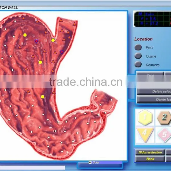 Fast Detection Diacom 3D Body Health Analyzer photo-4