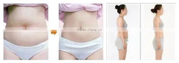 Best Cavitation Slimming Machine/Ultrasound Cavitation Machine + Free Profeesional Training photo-5
