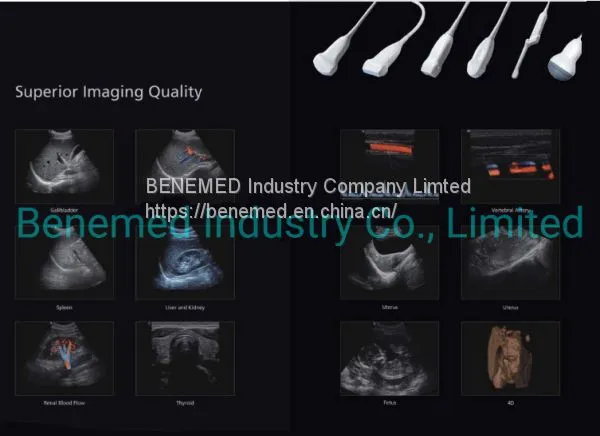 Premium 4D Color Doppler Ultrasound Scanner photo-5