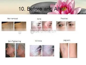 2015 Best Selling Well Machine 2 Hand Piece Filter is Changable photo-3