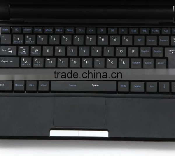 Clear Image Laptop Type Ultrasound Scanner System Full Digital Machine in Transport Carriage photo-2