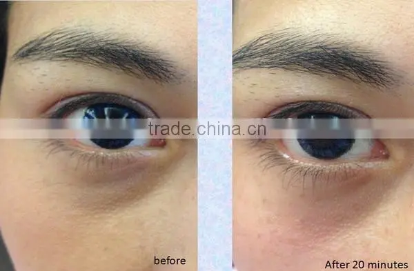 RF Face Lift Beauty Machine for Lighten Black Eye photo-5