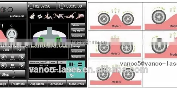 Distributor Wanted Vacuum Rooler Massage Machine photo-2