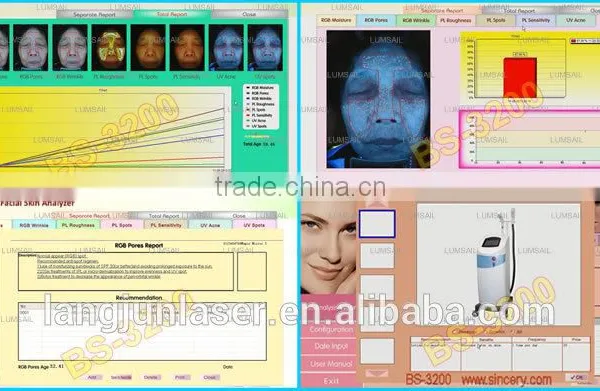 2016 Latest Amazing Magic Skin Analyzer, Skin Scope Analyzer photo-5