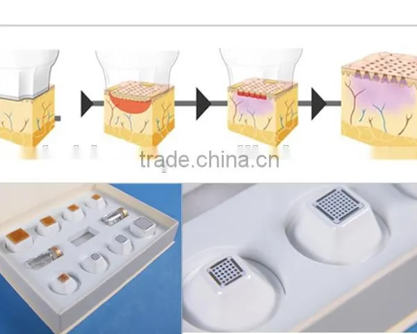 Hot Sale Portable Home-use RF Thermacool Wrinkles Eliminate and Facial Shape BR818 With CE photo-6
