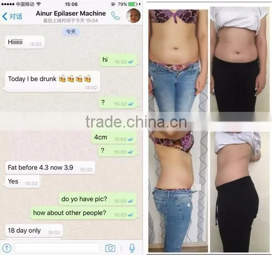 Criolipolisis Lipo Cryo Fat Freeze Belt/cool Tech Fat Freezing Machine photo-2