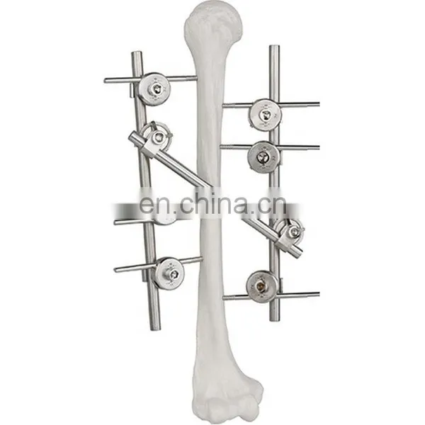 Guaranteed Quality Semi-circular External Fixator Orthopedic Surgical Implant photo-5