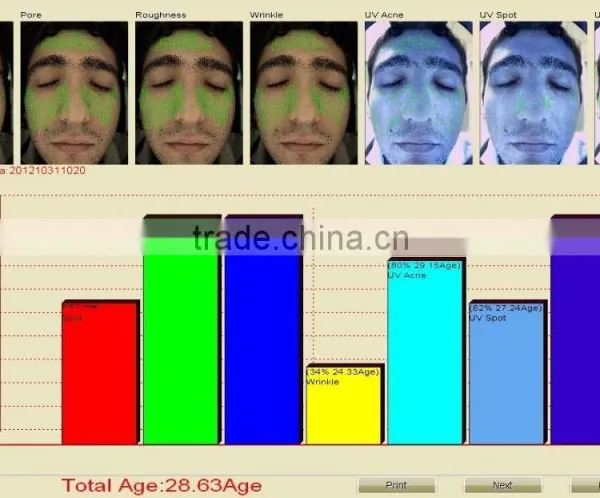 Computer Software Skin Analysis System Acne Wrinkle Spot Pore Analyzer Device photo-6